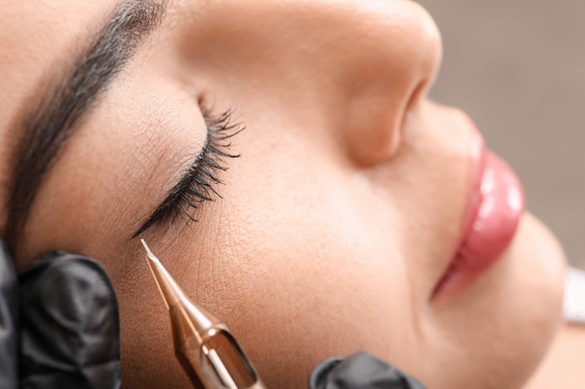dermopigmentation