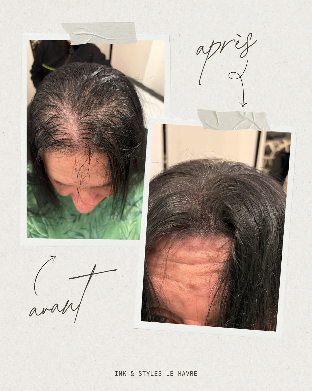 Post Instagram Avant Après Cosmétique Beauté Collage Photo Beige Minimaliste